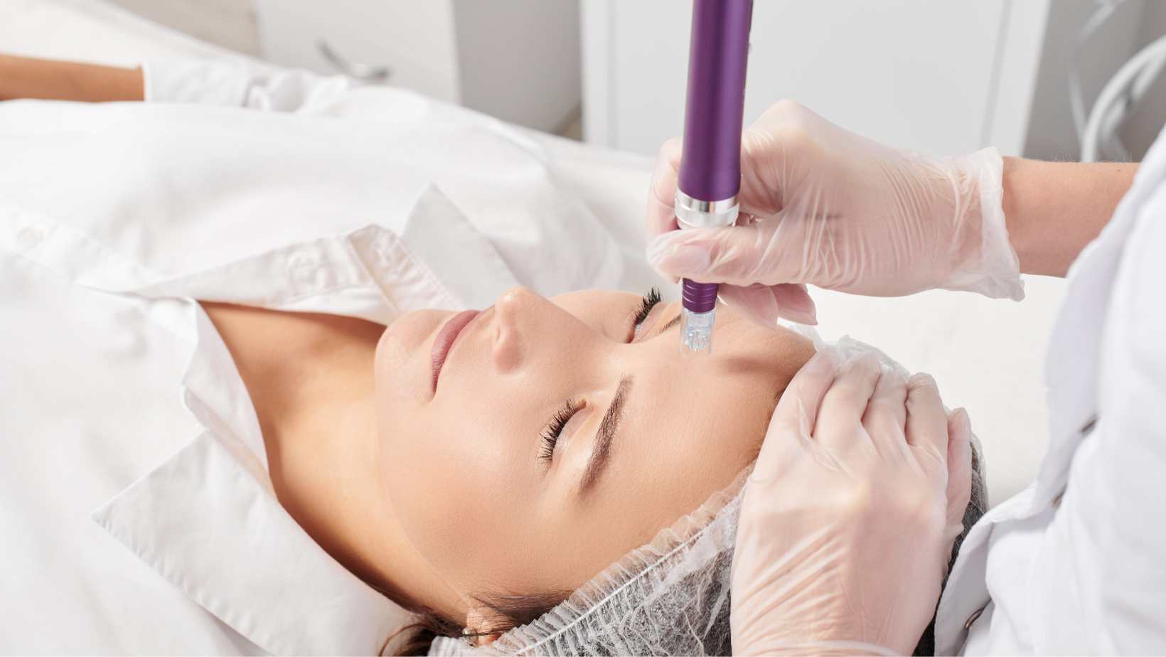 Microneedling location