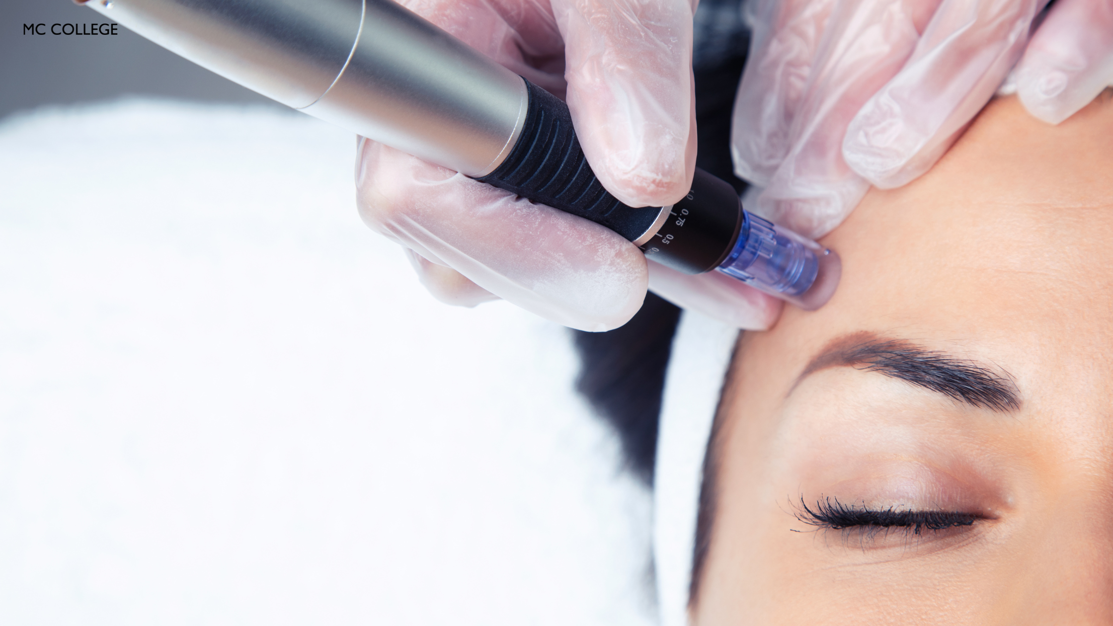 Advanced Class: Microneedling location